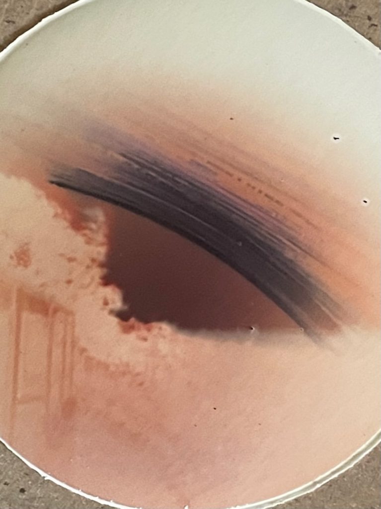 6 months of winter sun and rain